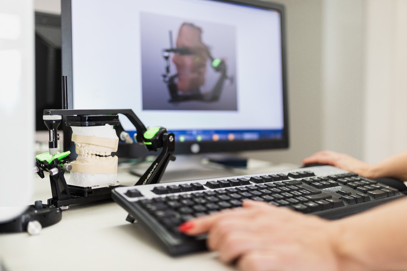 Digitale Planung am Bildschirm mit Modell im Artikulator